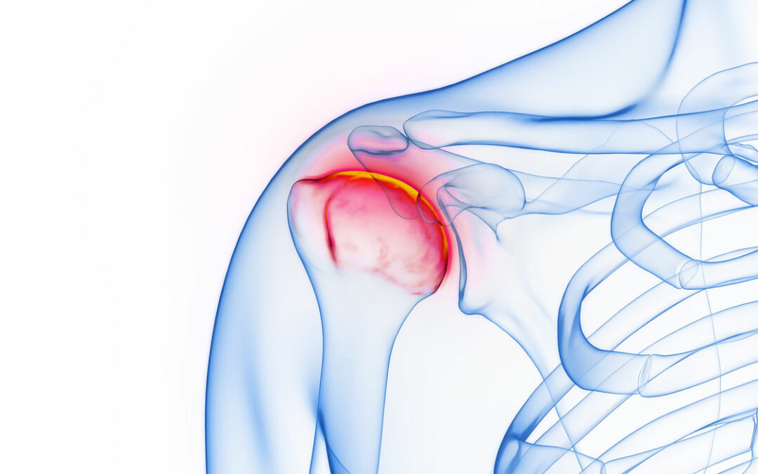 What is Enthesitis and How Does Does it Relate to Ankylosing Spondylitis?